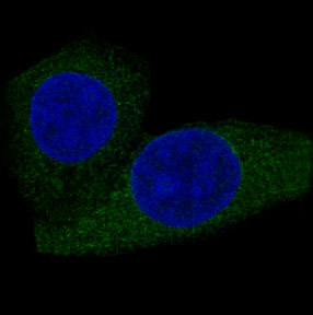 3 - Anti-CPT2 Rabbit Monoclonal Antibody ABO13417