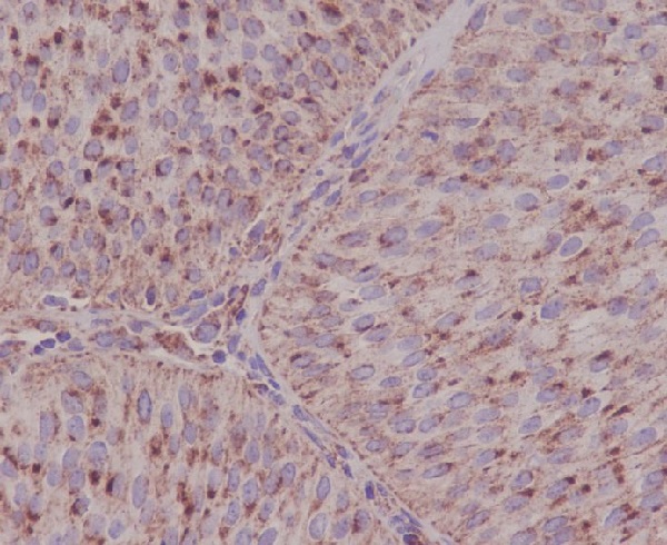 2 - Anti-ASNS/Asparagine Synthetase Rabbit Monoclonal Antibody ABO13418