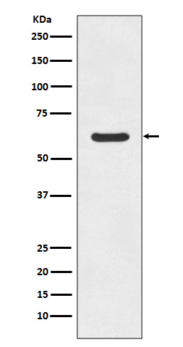 1 - Anti-ASNS/Asparagine Synthetase Rabbit Monoclonal Antibody ABO13418