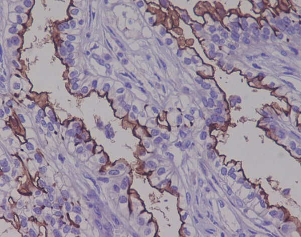 2 - Anti-MUC1 Rabbit Monoclonal Antibody ABO13419