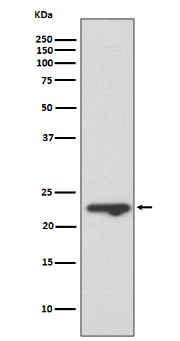 1 - Anti-MUC1 Rabbit Monoclonal Antibody ABO13419