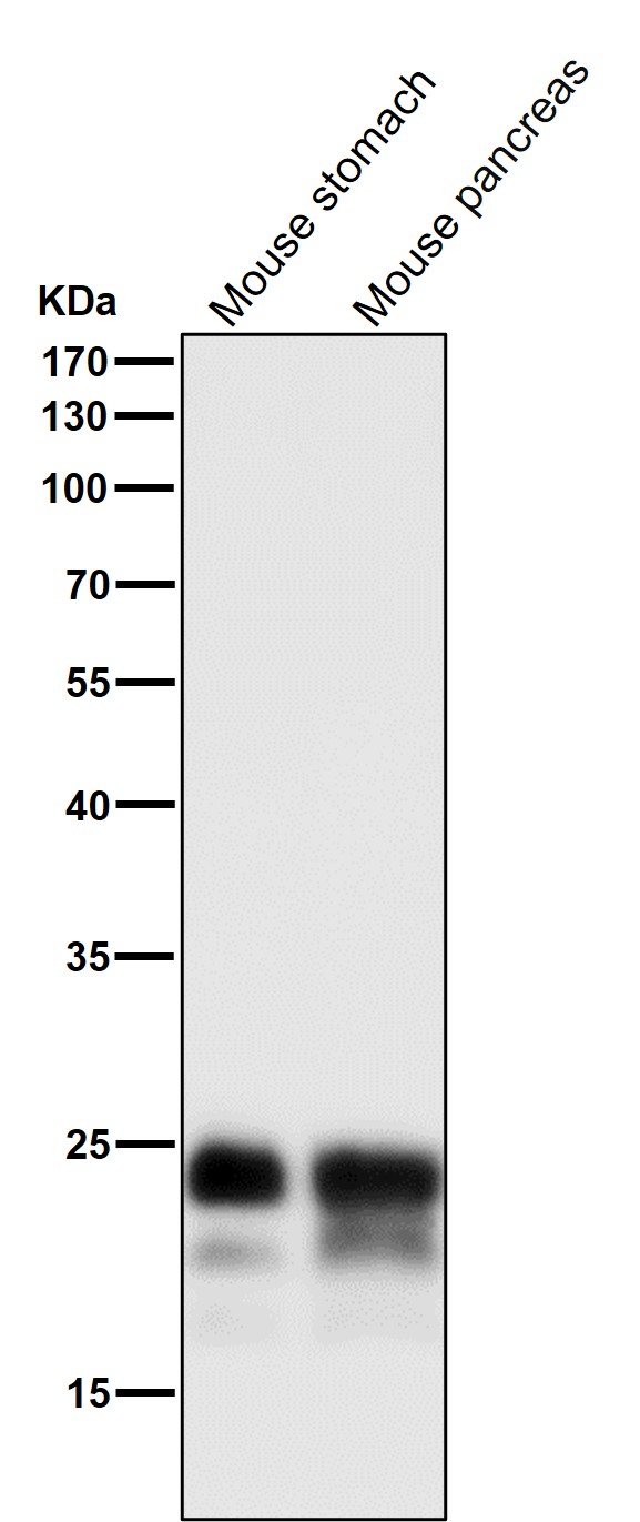 1 - Anti-MUC1 Rabbit Monoclonal Antibody ABO13419