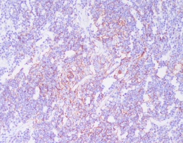 2 - Anti-CD21 CR2 Rabbit Monoclonal Antibody ABO13420