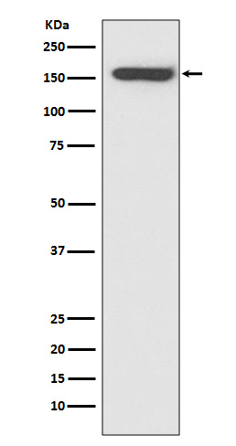 1 - Anti-CD21 CR2 Rabbit Monoclonal Antibody ABO13420