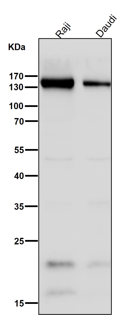 1 - Anti-CD21 CR2 Rabbit Monoclonal Antibody ABO13420