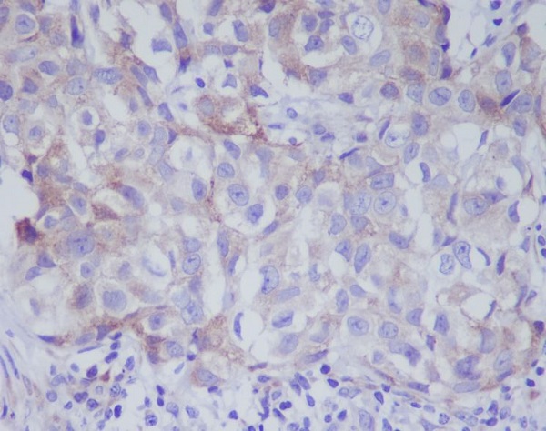 2 - Anti-VAV2 Rabbit Monoclonal Antibody ABO13421