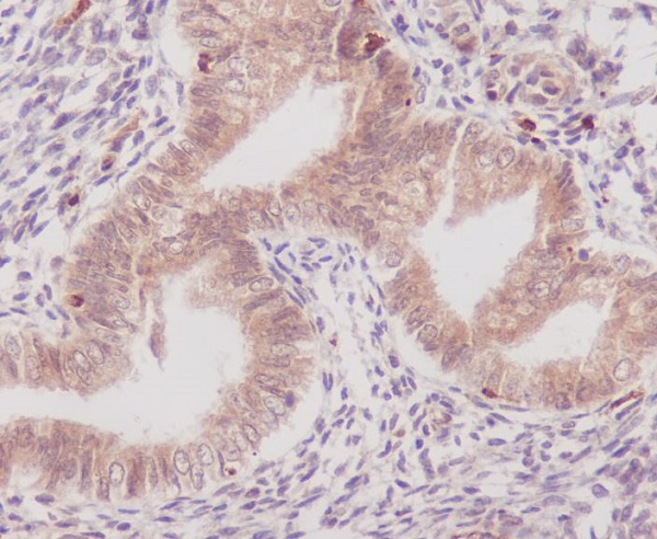 2 - Anti-COX1 PTGS1 Rabbit Monoclonal Antibody ABO13422