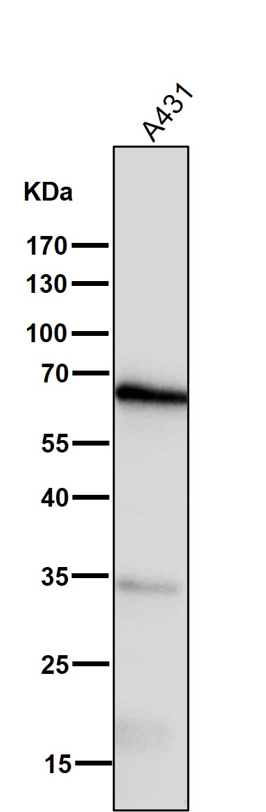 1 - Anti-COX1 PTGS1 Rabbit Monoclonal Antibody ABO13422