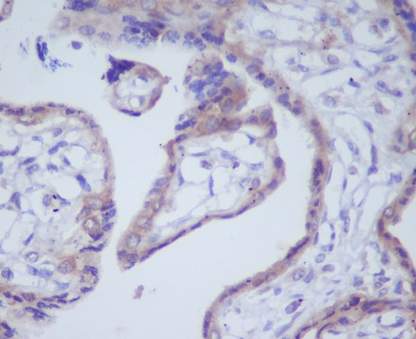 2 - Anti-DKK1 Rabbit Monoclonal Antibody ABO13423
