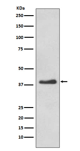 1 - Anti-DKK1 Rabbit Monoclonal Antibody ABO13423