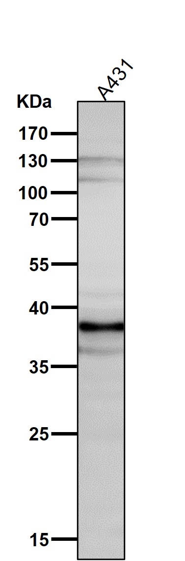 1 - Anti-DKK1 Rabbit Monoclonal Antibody ABO13423