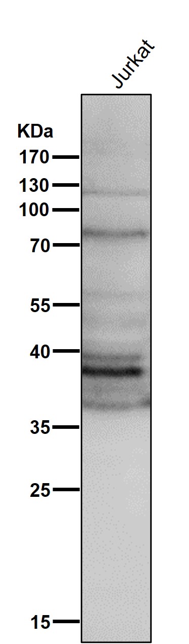 1 - Anti-DKK1 Rabbit Monoclonal Antibody ABO13423