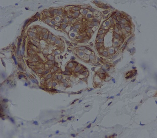 2 - Anti-CD14 Rabbit Monoclonal Antibody ABO13424