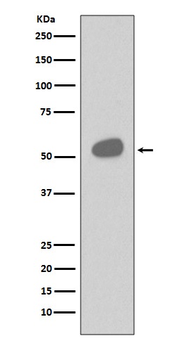 1 - Anti-CD14 Rabbit Monoclonal Antibody ABO13424