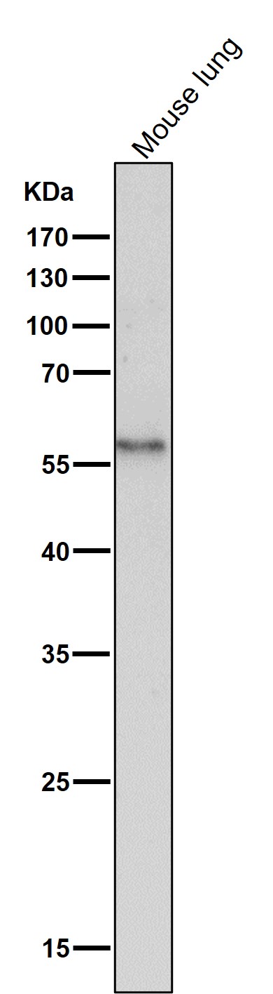 1 - Anti-CD14 Rabbit Monoclonal Antibody ABO13424