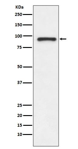 1 - Anti-TOP1/Topoisomerase I Rabbit Monoclonal Antibody ABO13425