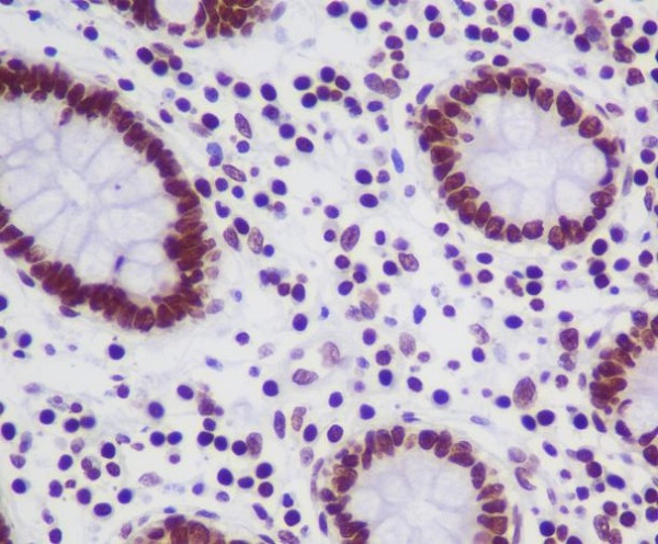 2 - Anti-TOP1/Topoisomerase I Rabbit Monoclonal Antibody ABO13425