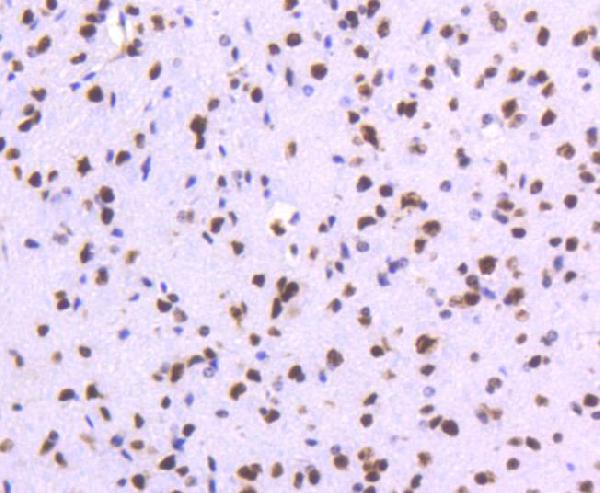 2 - Anti-TOP1/Topoisomerase I Rabbit Monoclonal Antibody ABO13425