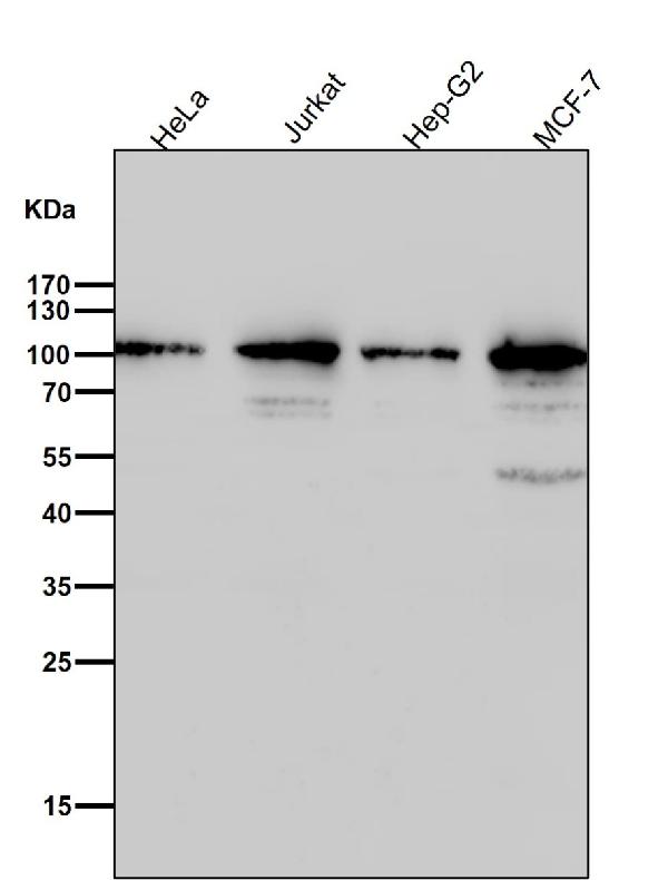1 - Anti-TOP1/Topoisomerase I Rabbit Monoclonal Antibody ABO13425