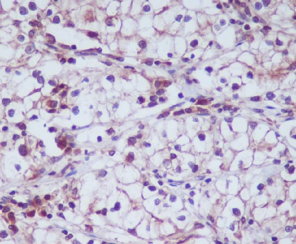 2 - Anti-CD13 ANPEP Rabbit Monoclonal Antibody ABO13426