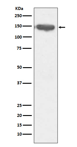 1 - Anti-CD13 ANPEP Rabbit Monoclonal Antibody ABO13426