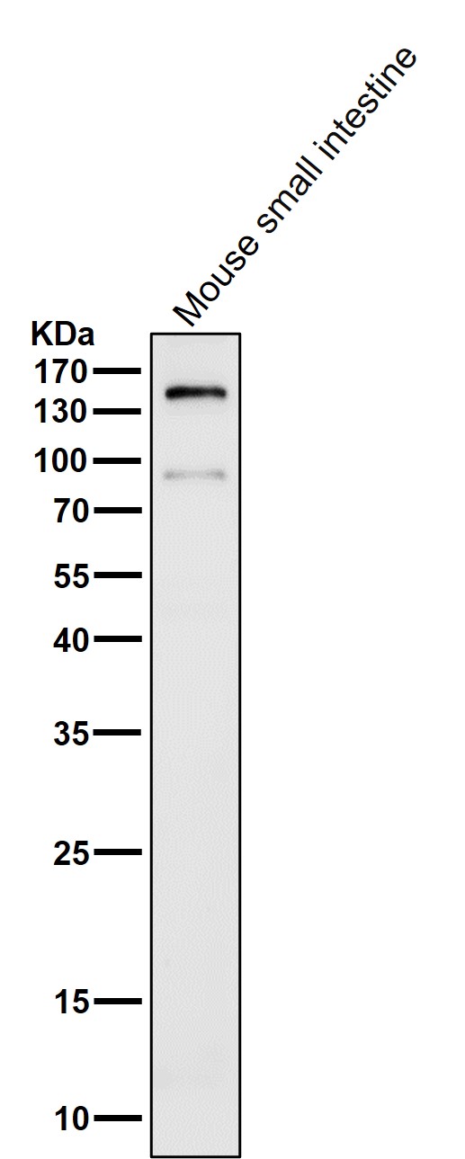 1 - Anti-CD13 ANPEP Rabbit Monoclonal Antibody ABO13426