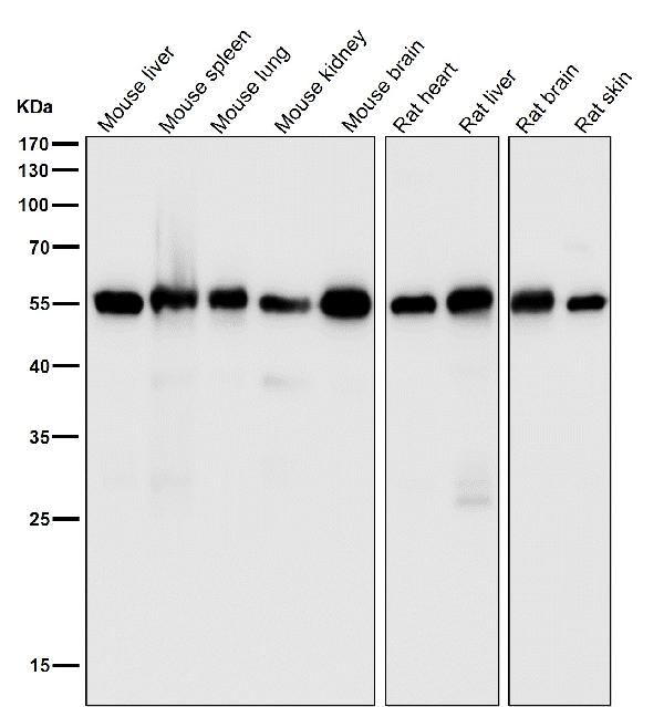 1 - Anti-CYBB/Nox2 Rabbit Monoclonal Antibody ABO13427