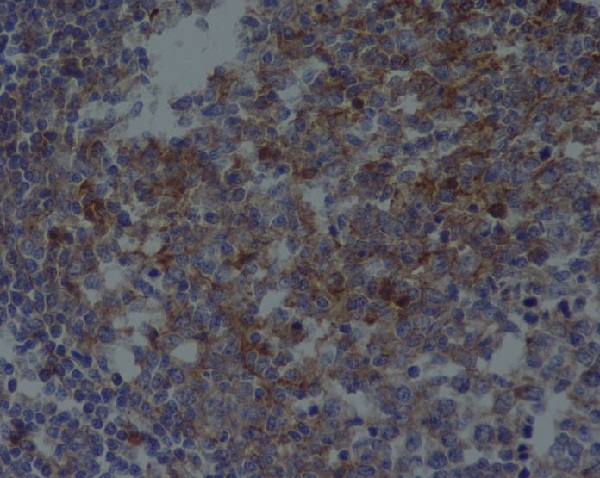 2 - Anti-CD81 Rabbit Monoclonal Antibody ABO13428