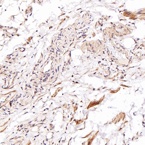 2 - Anti-CD81 Rabbit Monoclonal Antibody ABO13428