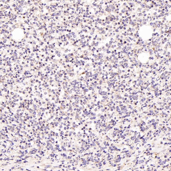 2 - Anti-CD81 Rabbit Monoclonal Antibody ABO13428