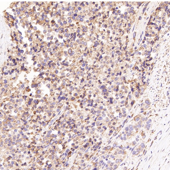 2 - Anti-CD81 Rabbit Monoclonal Antibody ABO13428