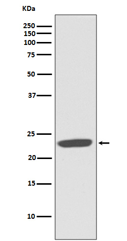 1 - Anti-CD81 Rabbit Monoclonal Antibody ABO13428