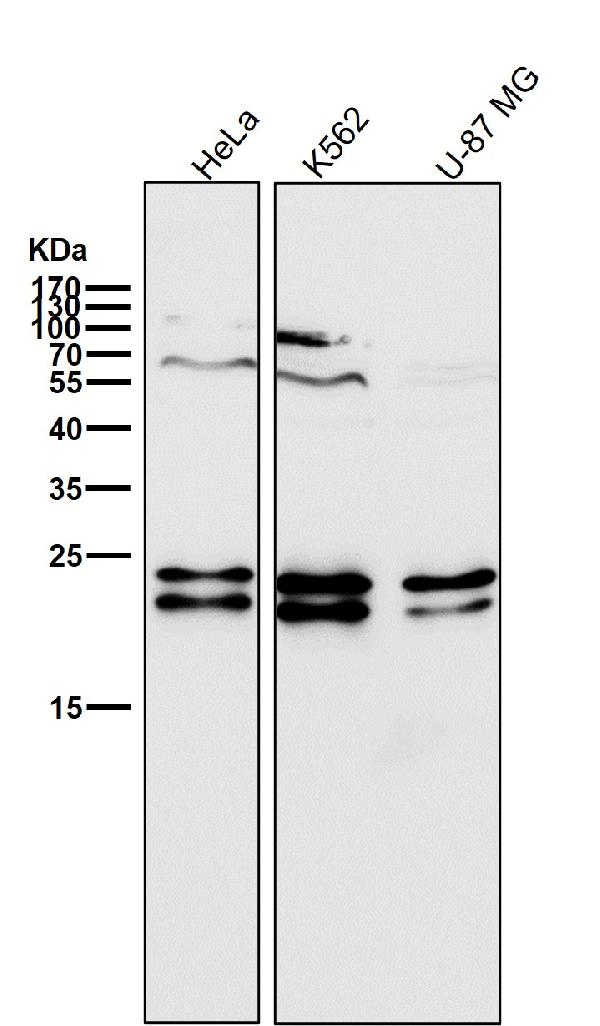 1 - Anti-CD81 Rabbit Monoclonal Antibody ABO13428