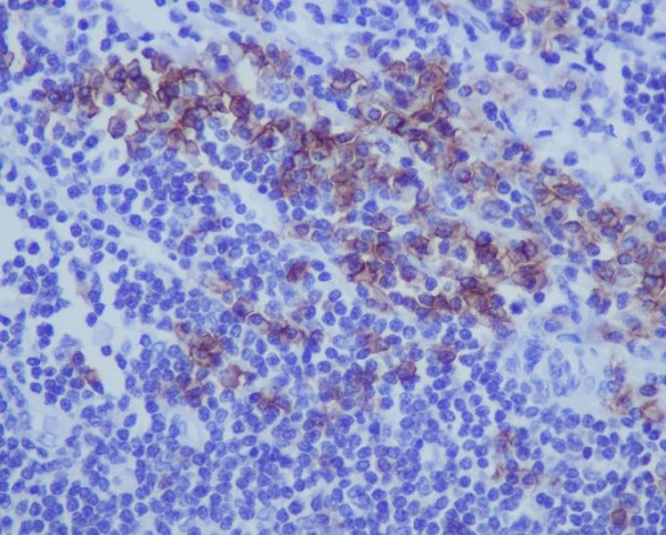 2 - Anti-CD38 Rabbit Monoclonal Antibody ABO13429