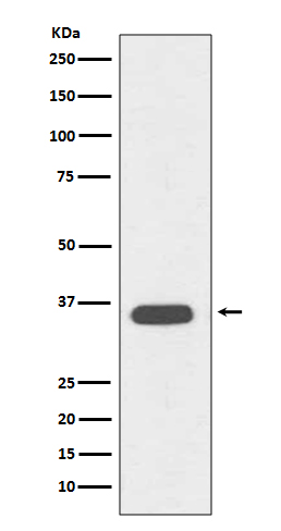 1 - Anti-CD68/Sr D1 Rabbit Monoclonal Antibody ABO13431