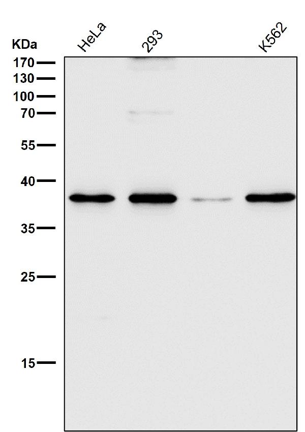 1 - Anti-CD68/Sr D1 Rabbit Monoclonal Antibody ABO13431