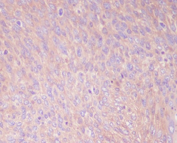2 - Anti-PKM2 Rabbit Monoclonal Antibody ABO13433