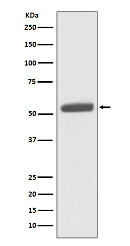 1 - Anti-PKM2 Rabbit Monoclonal Antibody ABO13433