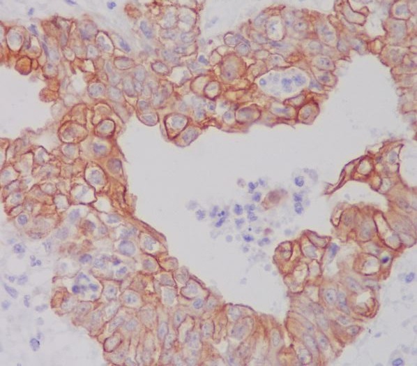 2 - Anti-ATG5/Apg5 Rabbit Monoclonal Antibody ABO13434