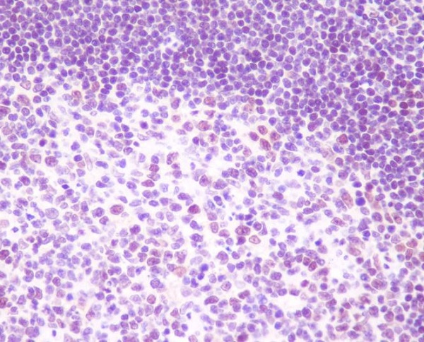 2 - Anti-RelB Rabbit Monoclonal Antibody ABO13435