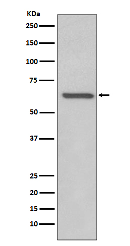 1 - Anti-RelB Rabbit Monoclonal Antibody ABO13435