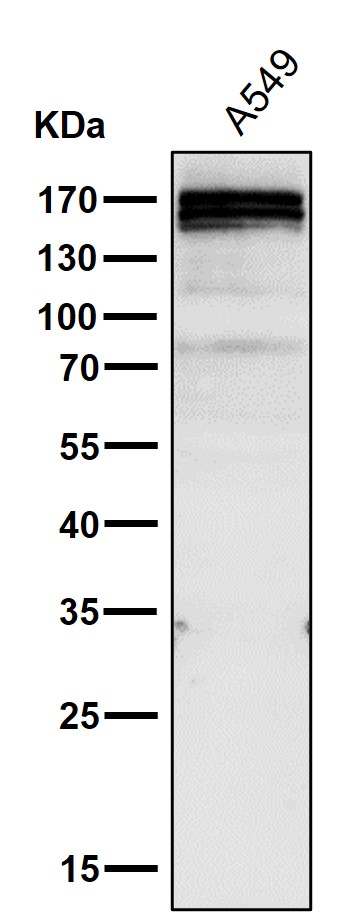 1 - Anti-RelB Rabbit Monoclonal Antibody ABO13435
