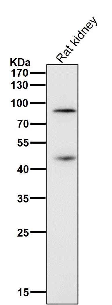 1 - Anti-Gli1 Rabbit Monoclonal Antibody ABO13436