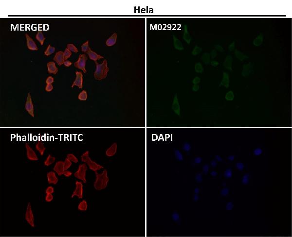 1 - Anti-AGR2/Ag 2 Rabbit Monoclonal Antibody ABO13437