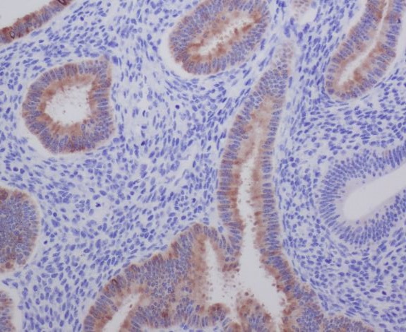 2 - Anti-AGR2/Ag 2 Rabbit Monoclonal Antibody ABO13437