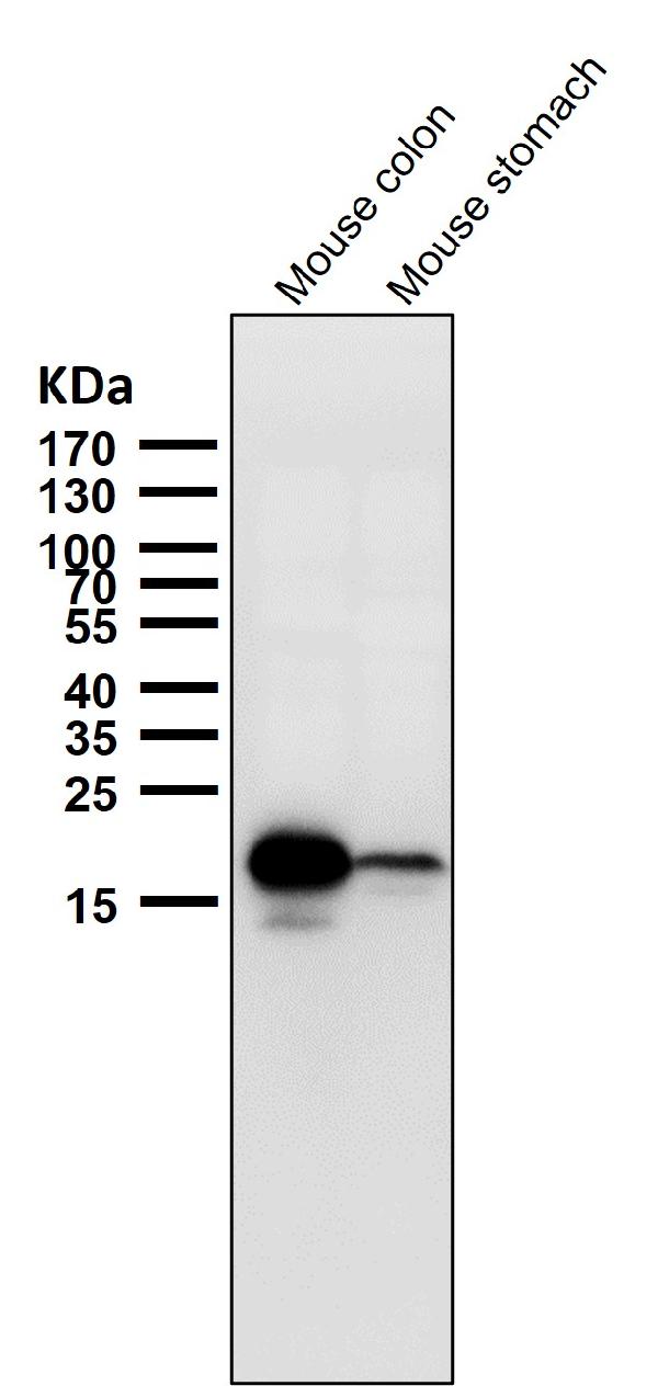 1 - Anti-AGR2/Ag 2 Rabbit Monoclonal Antibody ABO13437