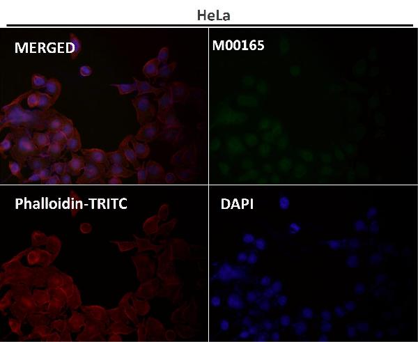 1 - Anti-IRF3 Rabbit Monoclonal Antibody ABO13438