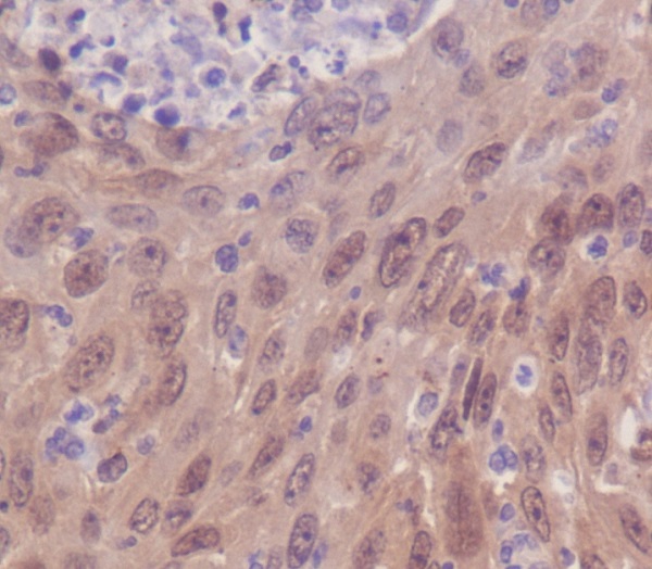 2 - Anti-IRF3 Rabbit Monoclonal Antibody ABO13438