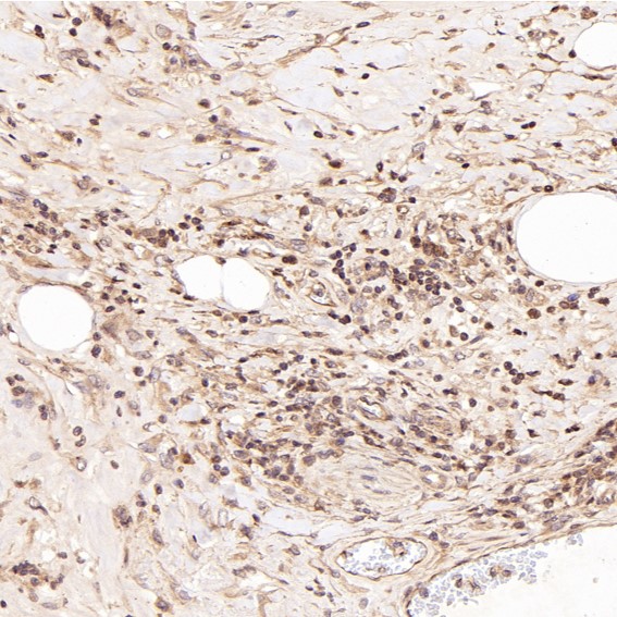 2 - Anti-IRF3 Rabbit Monoclonal Antibody ABO13438