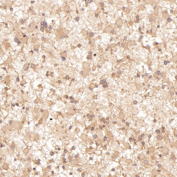 2 - Anti-IRF3 Rabbit Monoclonal Antibody ABO13438